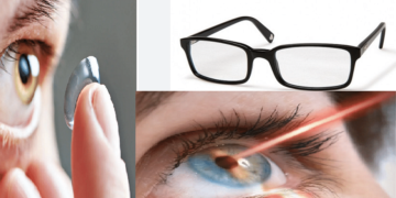 நவீன உபகரணங்களைக் கொண்டு கண் பார்வை திறனை சரிசெய்து கொள்ளலாம் விரிவான தகவல்.!